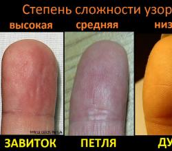 Папиллярные узоры на пальцах Завитки дуги петли на пальцах значение